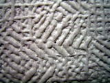針を刺した痕